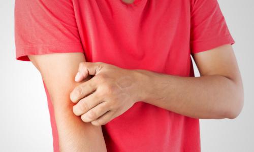 Ekcéma: típusai, kiváltó okai és a bőr helyreállításának lehetőségei